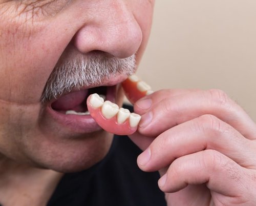 man removing dentures. He learns to live without his teeth.