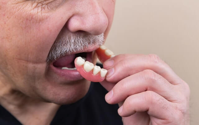 man removing dentures. He learns to live without his teeth.